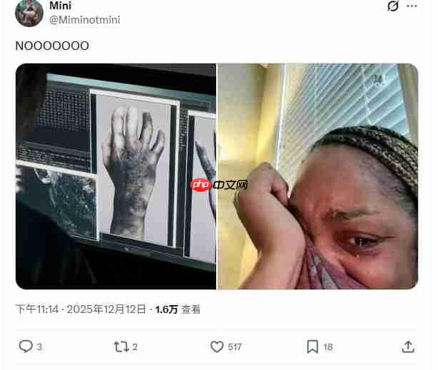 《生化危机9》惊悚细节：里昂疑似中了病毒