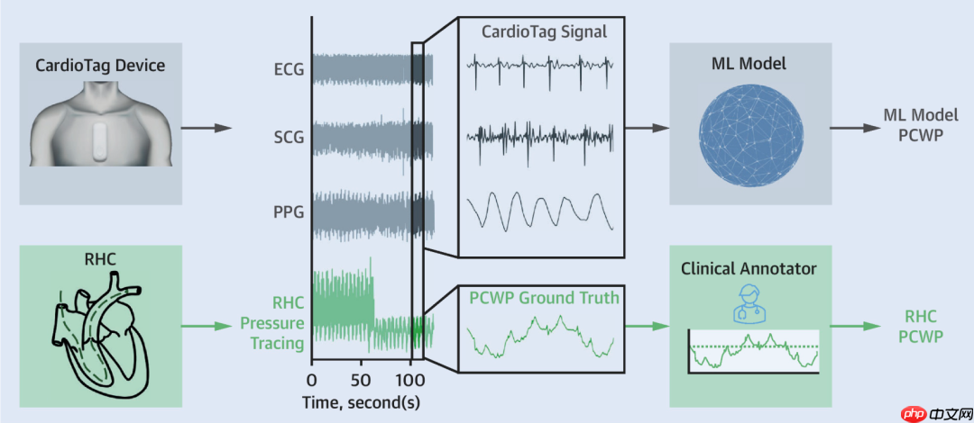 创新医疗新参数-SCG（心震图）：详细解读版