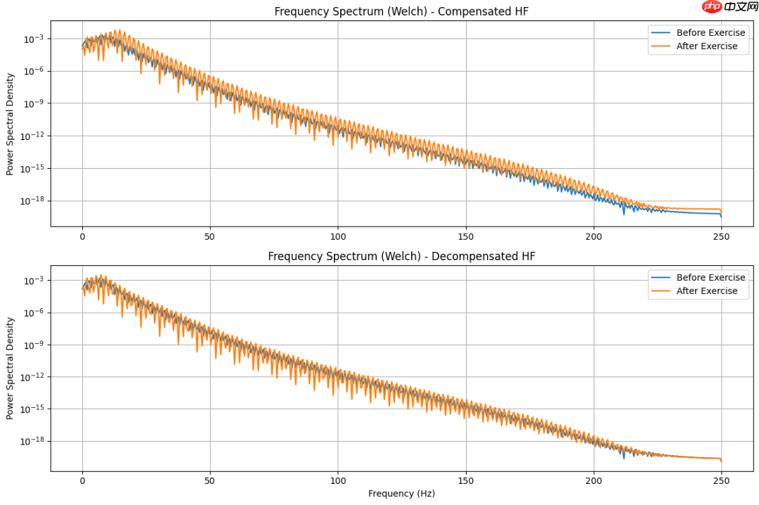 创新医疗新参数-SCG（心震图）：详细解读版