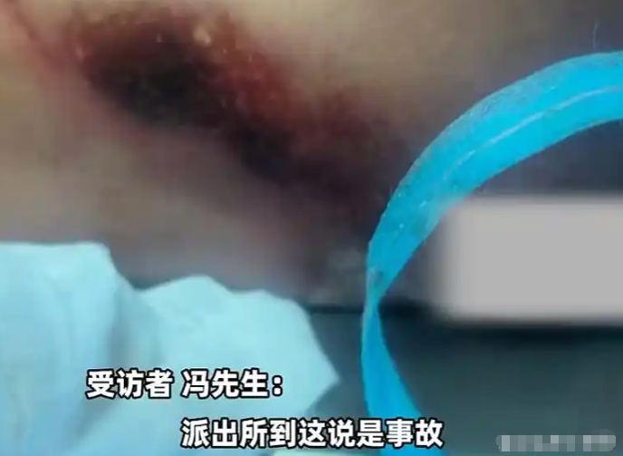 悲剧!河北女子骑车被狗撞倒身亡,主人为躲赔偿将狗打死 - php中文网