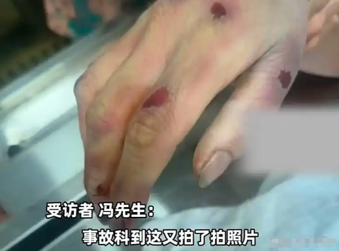 悲剧!河北女子骑车被狗撞倒身亡,主人为躲赔偿将狗打死 - php中文网