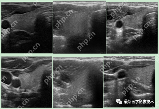 USenhance2023——2023 年超声图像增强挑战赛