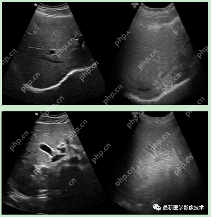 USenhance2023——2023 年超声图像增强挑战赛