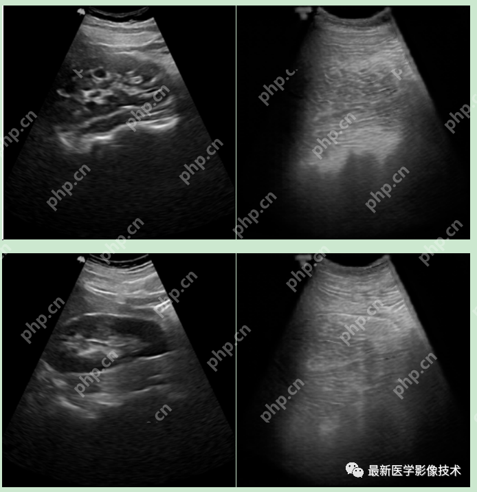 USenhance2023——2023 年超声图像增强挑战赛